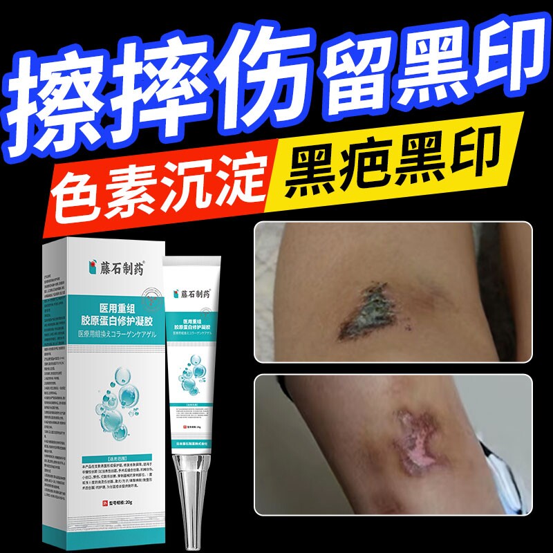 擦伤摔伤疤痕膏医用脸上膝盖破皮黑印黑色素沉淀药房同售膏SK