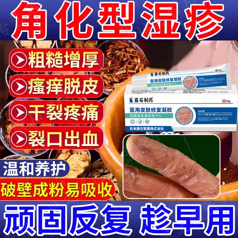 角化型湿疹手癣泡手包药房同款脱皮干裂真菌感染皲裂性手脚膏CA