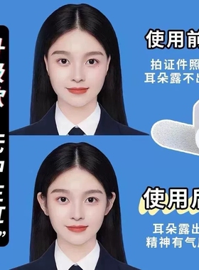 精灵耳贴拯救贴面耳固定定型拍照显脸小柔软加厚隐形硅胶立耳耳贴