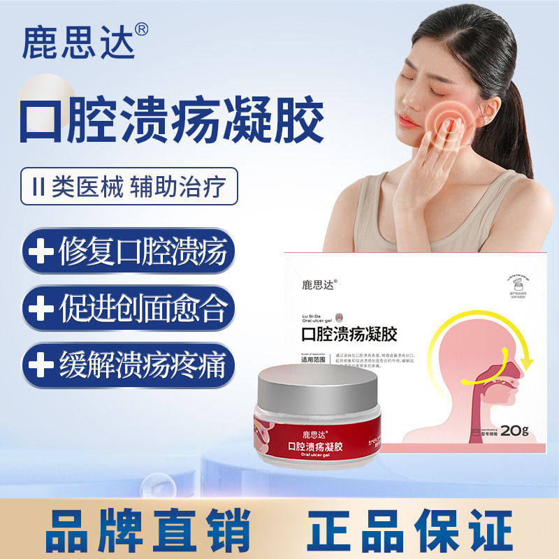 鹿思达口腔溃疡凝胶溃疡