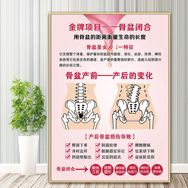 骨盆修复海报产后恢复中心装饰画骨盆闭合宣传图产后修复宣传挂画