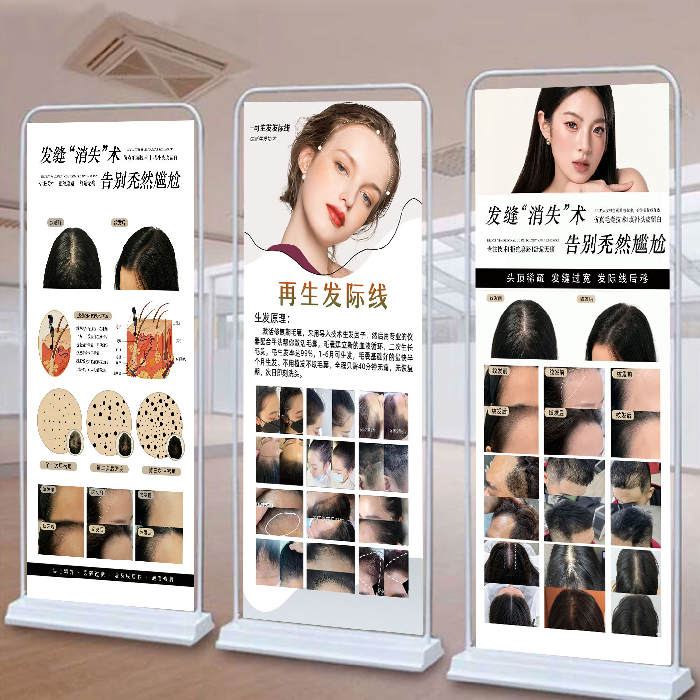 纹发海报纹发缝宣传smp植发图片