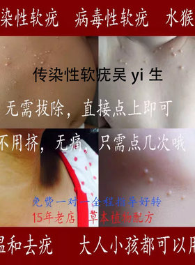 儿童传染性软疣病毒性软疣水猴子