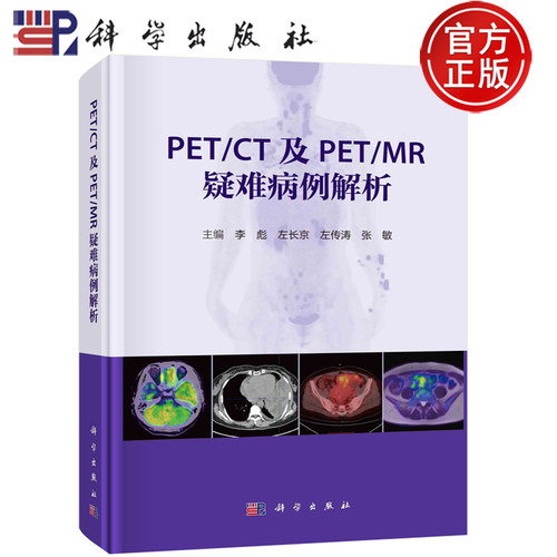PET/CT及PET/MR疑难病例解析