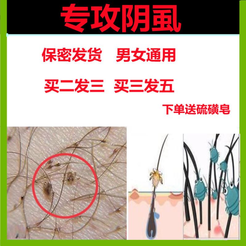 虱子药大人用一扫光儿童小女孩去除头发虱卵阴虱百部酊灭床上跳蚤