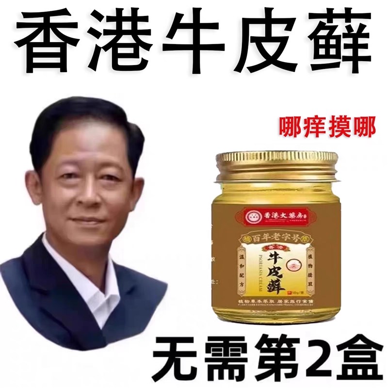 香港大药房牛皮药膏藓头皮股银去M屑病皮肤止痒神器癣