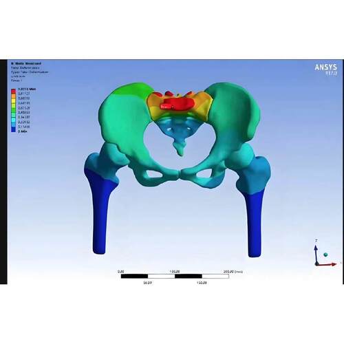MIMICS医学有限元CT骨科牙齿血管肿瘤流体口腔3D打印建模彷真代做