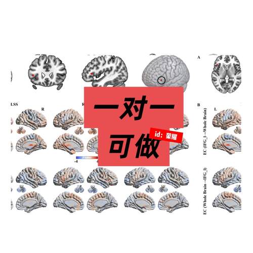 影像组学深度学习ROI勾画三维重建临床预测组学建模神经影像fMR