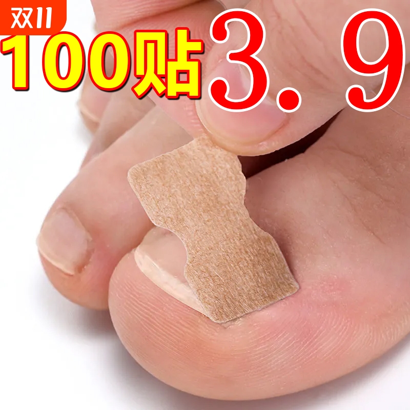 甲沟炎矫正神器脚指甲长肉里专用正甲贴片甲沟嵌甲矫正器趾甲工具