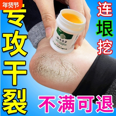 专治脚裂脚后跟干裂起硬皮足跟开裂真菌防皲裂脱皮修复霜药膏脚跟