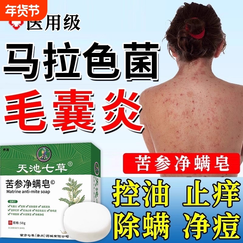 硫磺皂毛囊炎香皂马拉色菌药背上后背长痘痘除螨祛痘痒疼沐浴露