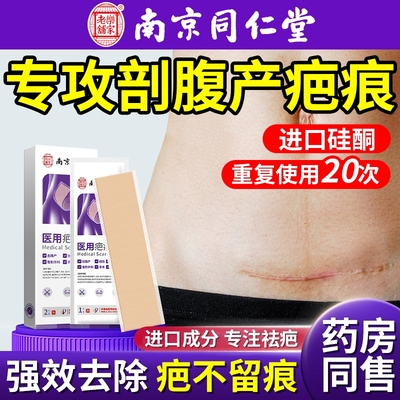 祛疤贴医用疤痕硅酮凝胶剖腹产产后妊娠纹增生凸起修复疤痕除疤膏