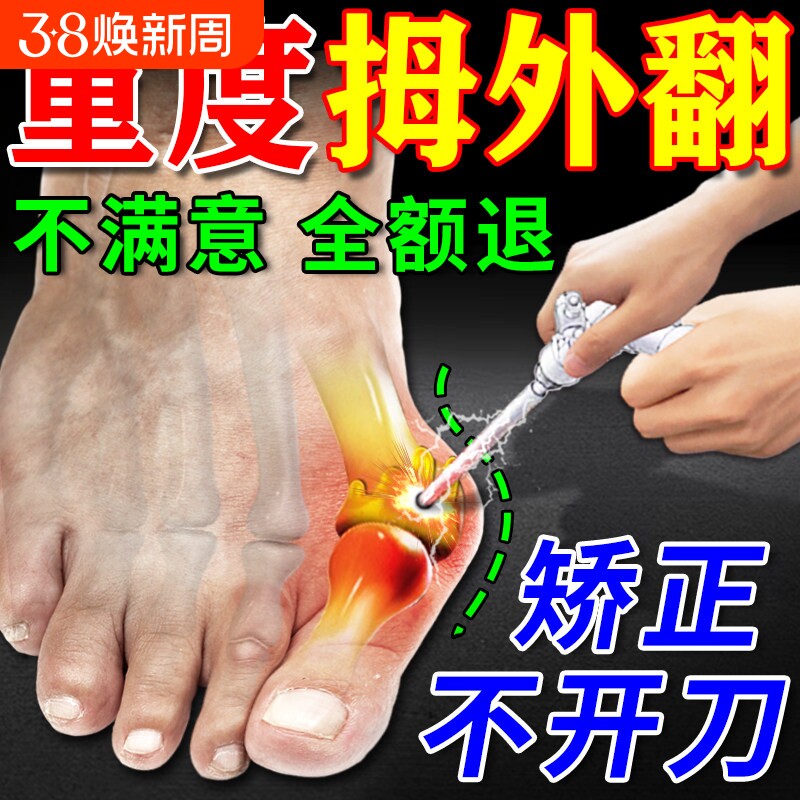 拇指外翻药膏贴拇囊炎疼痛大脚骨变形脚趾畸形肿胀矫正神器女克星