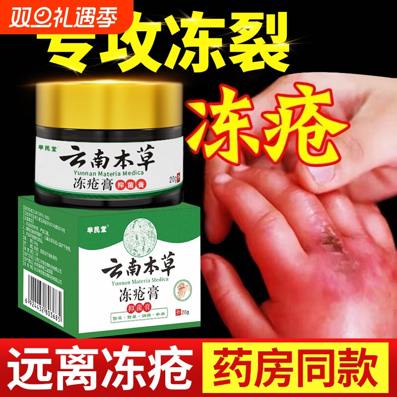 冻疮膏止痒冻伤膏防裂冻正品耳朵脸部消肿儿童冻手神器防冻霜抑菌