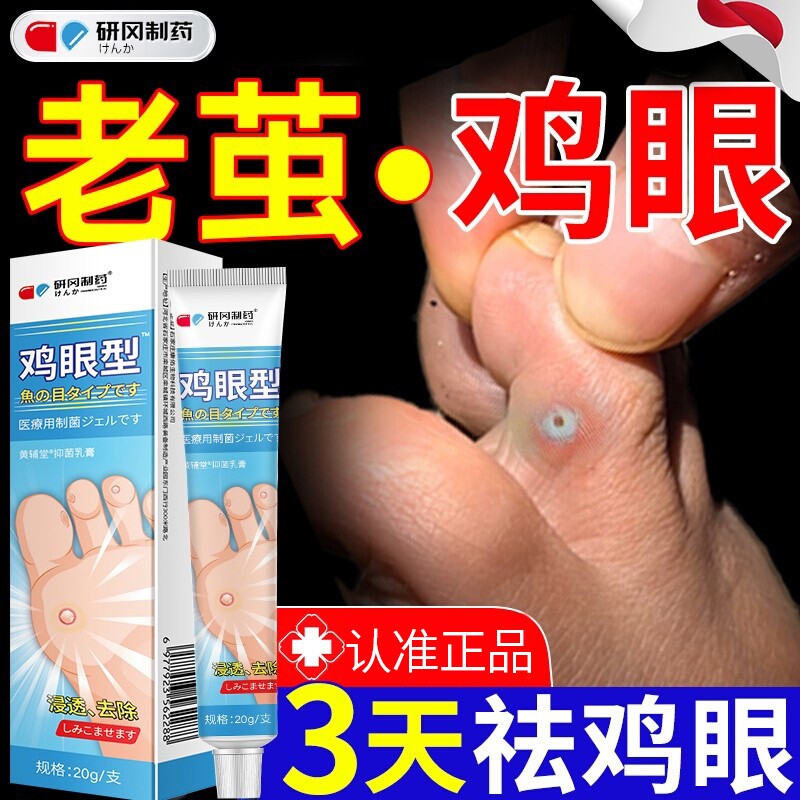【正品】鸡眼膏鸡贴眼膏去除扁平疣跖疣疣老茧肉刺粒脚底足部药膏