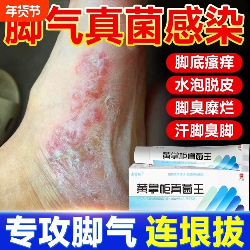 真菌王官网正品脚臭止痒脱皮脚痒水泡烂大腿内侧抑菌杀菌膏,保健用品,皮肤消毒护理（消）,淘宝优惠券,粉丝福利购,淘宝优惠卷
