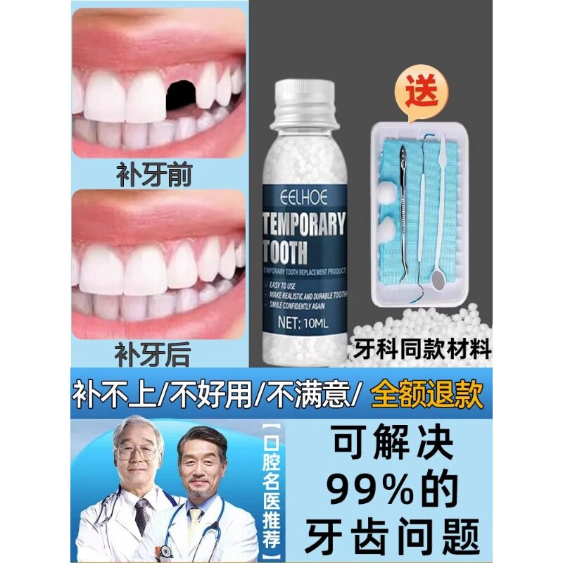口腔护理神器自己补牙材料树脂假牙套牙仿真牙齿缺牙填充修复