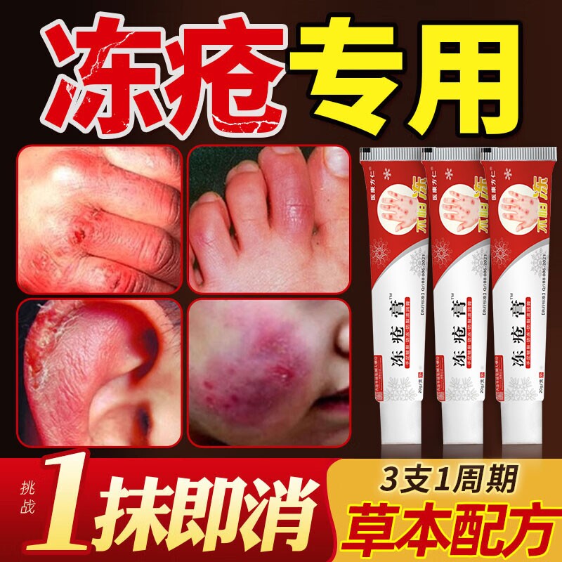 冻疮膏止痒冻伤膏正品官方旗舰店儿童耳朵手指脸部冻伤皮肤护理