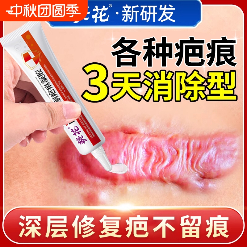 院线热卖！葵花医用祛疤膏NO.I