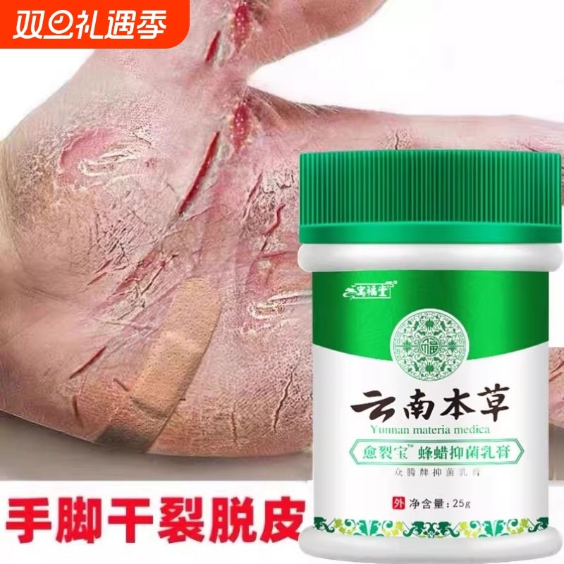 手裂口干修复霜防裂手足龟裂开裂皲裂治脚后跟干裂脱皮马油皱裂膏