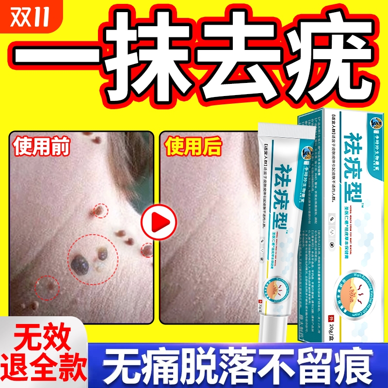 去扁平疣一抹灵|349人收藏