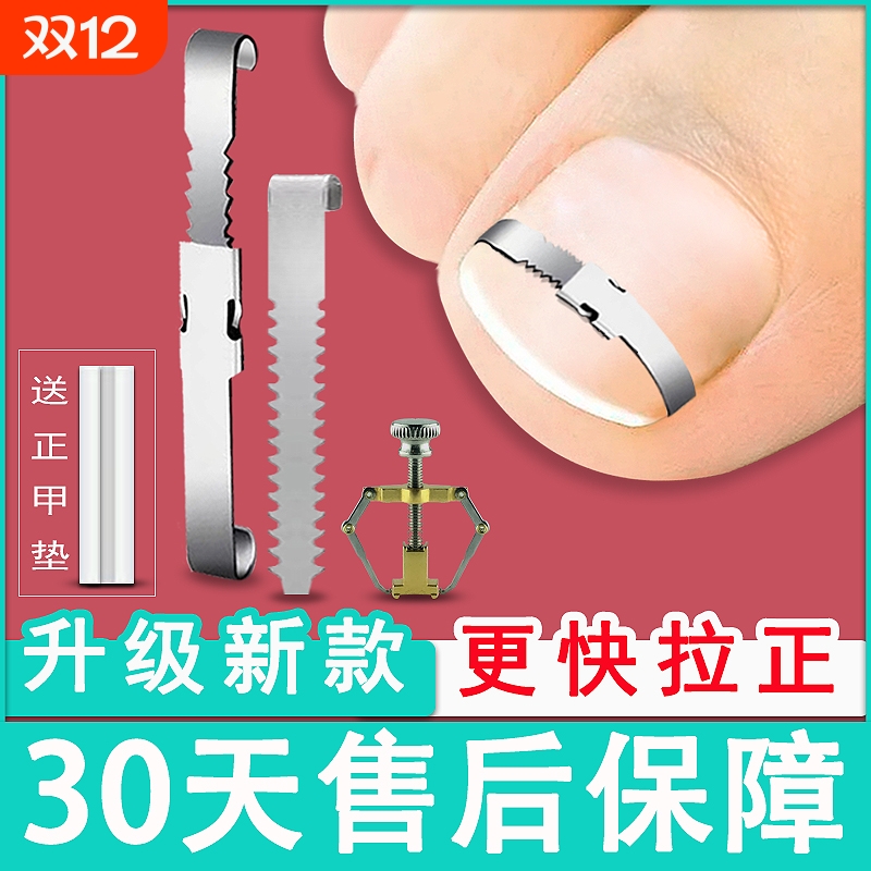 嵌甲矫正器全套一次带走用创新款