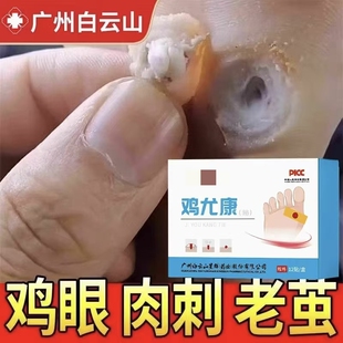 鸡眼贴去鸡眼神器老茧鸡贴眼脚钉祛除膏鸡茧眼足部鸡贴眼膏正品