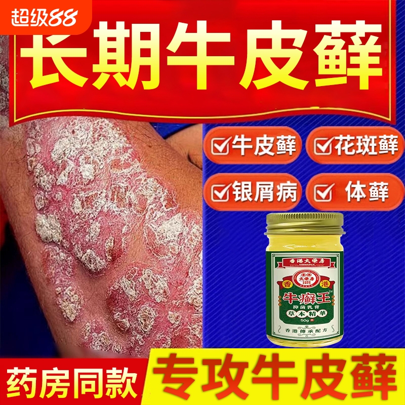 香港牛藓王牛皮痒癣头皮股银去屑病专用膏正品皮肤杀菌止抑菌痒