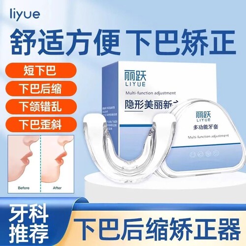 下颌后缩矫正器颞下颌关节紊乱下巴后缩偏颌嘴凸大小脸歪牙齿矫正