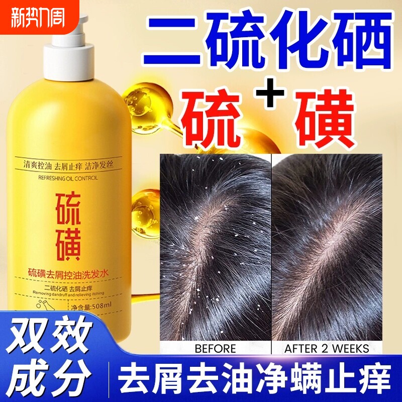 二硫化硒硫磺洗发水洗头膏毛囊去屑止痒沐浴露清洁去油头屑蓬松