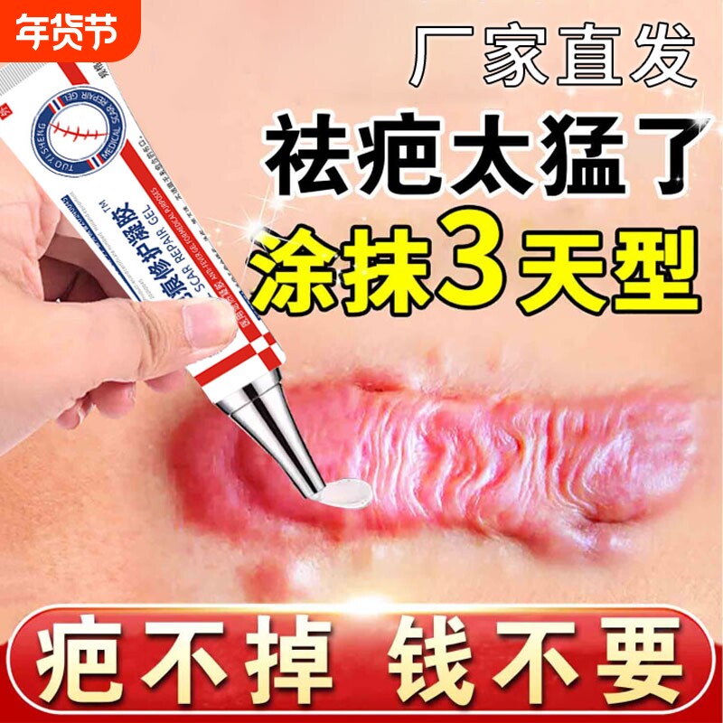 坨医生除疤膏正品医用烧伤烫伤妊娠疤痕凝胶增生凸起剖腹产疤痕