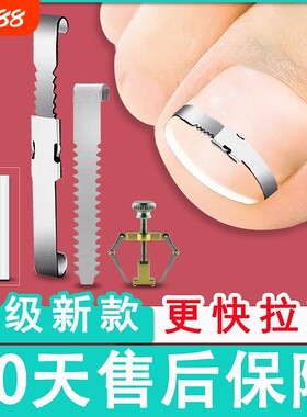 嵌甲矫正器全套一次带走用创新款