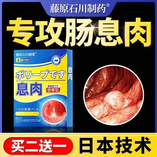 肠息肉中药贴克星慢性结肠炎直肠炎调理肚脐贴肠粘连肠梗阻胃息肉