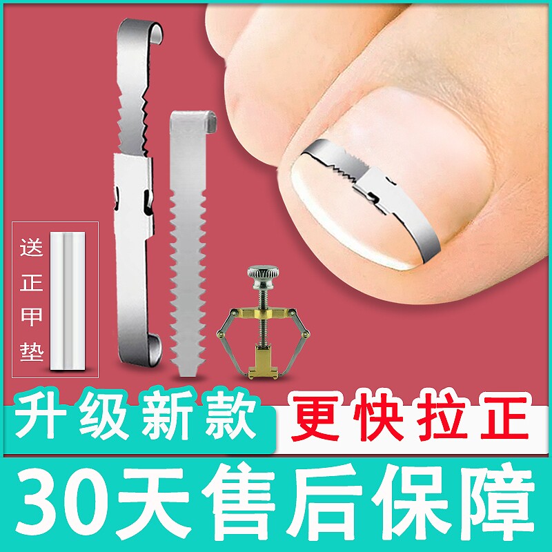 甲沟矫正器正甲扣嵌甲矫正器脚趾甲卷指甲纠正神器拉拉炎正甲贴片