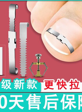 嵌甲矫正器全套一次带走用创新款