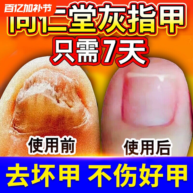 灰指甲专用阿莫同仁堂旗舰店修复脱甲膏罗芬真菌感染抑菌液搽剂