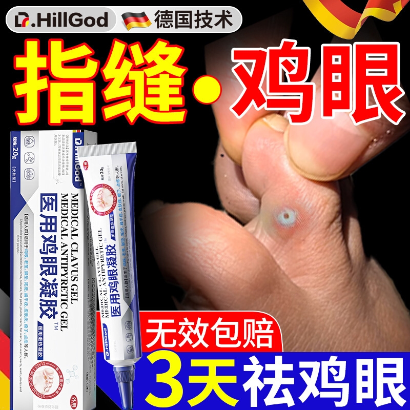 鸡眼膏钉祛除膏鸡茧眼去脚趾头缝硬老茧肉刺根专用膏神器医用级