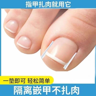 甲沟垫嵌甲指甲矫正器填充垫片正甲贴脚趾甲长肉里专用修甲刀棉花