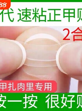 正甲贴片矫器内嵌扣德国沟卷
