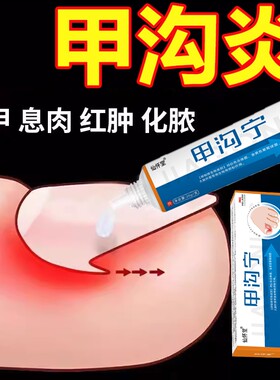 脚趾甲沟炎矫正器息肉软化剂药膏灰指甲脱甲膏凤仙花抑菌液脱甲液