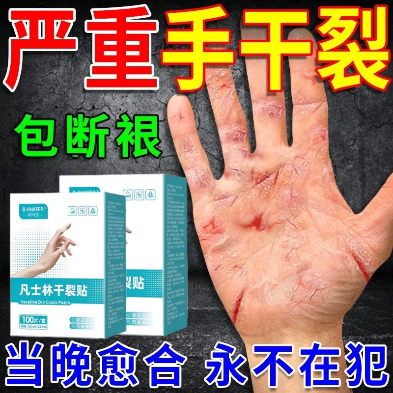 干裂贴手脚贴手足皲裂贴手指裂口贴脚后跟防裂贴胶布芦荟修复手部,居家日用,手部防护用品,淘宝优惠券,粉丝福利购,淘宝优惠卷