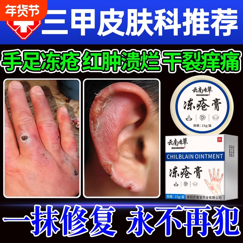 云南本草冻疮膏止痒冻伤膏正品官方旗舰店防冻裂手足冻耳朵伤消肿,保健用品,皮肤消毒护理（消）,淘宝优惠券,粉丝福利购,淘宝优惠卷
