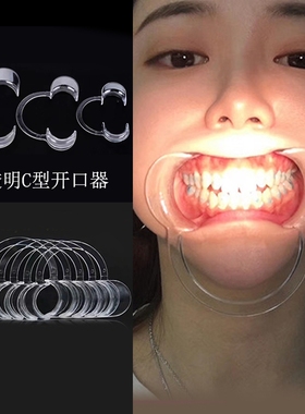 透明开口器牙科看牙洗牙扩嘴张口器牙齿美白牙结石撑嘴工具家用