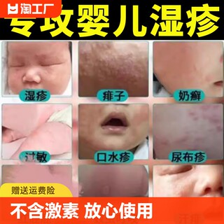 湿疹膏婴儿专用儿童宝宝湿疹口水疹无激素干性保湿面霜身体乳抑菌