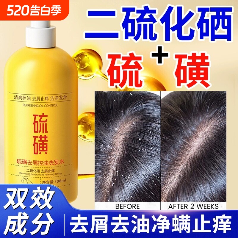二硫化硒硫磺洗发水洗头膏毛囊去屑止痒沐浴露清洁去油头屑蓬松