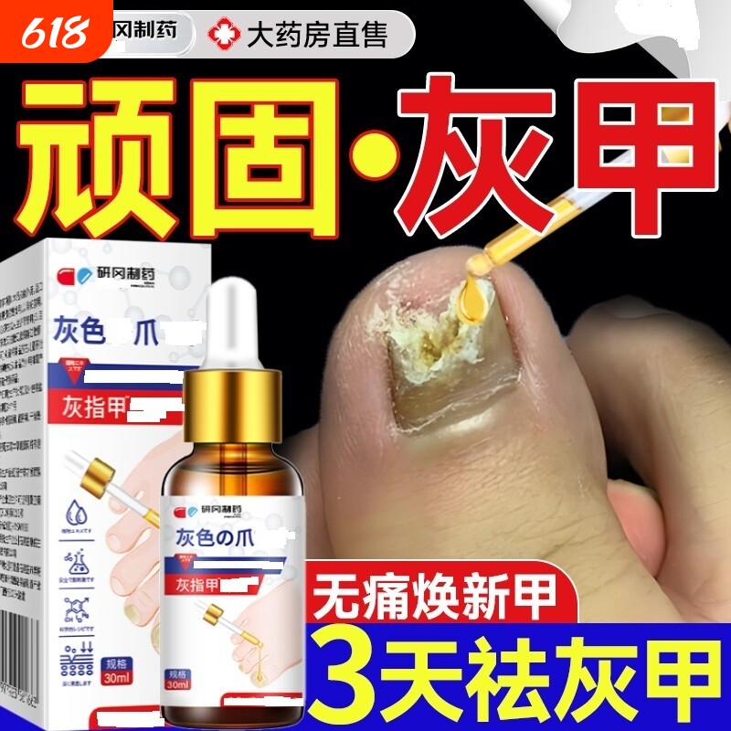 灰指甲专用抑菌液膏变厚治涂剂冰醋酸男正品旗舰店修复无痛甲床