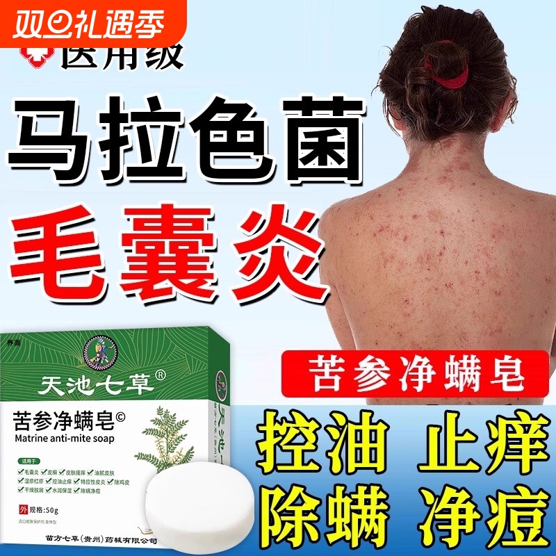 硫磺皂毛囊炎香皂马拉色菌药背上后背长痘痘除螨祛痘痒疼沐浴露