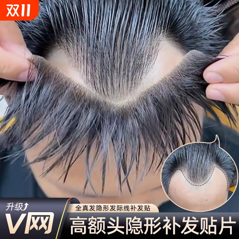 遮盖深v形m形发际线贴补发一片式