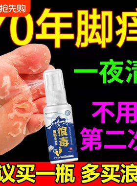 狼毒喷脚王喷雾剂水泡型脱皮感染专用止痒臭脚软膏真菌非杀菌正品