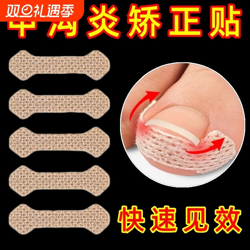 护指贴指甲修护矫形贴灰指甲手足部护理甲沟炎护甲贴嵌甲脚趾头贴